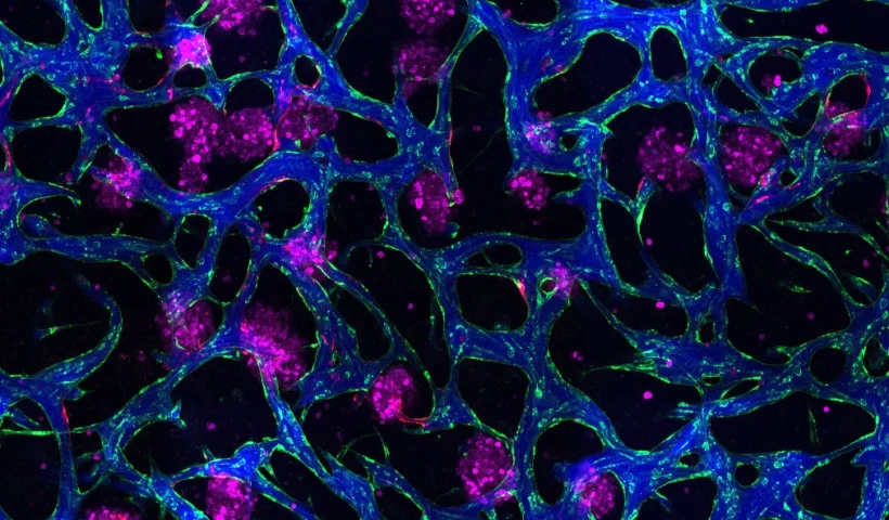 MIT створив мікромодель печінки з судинами та імунними клітинами: прорив у дослідженні MASLD і пошуку ліків